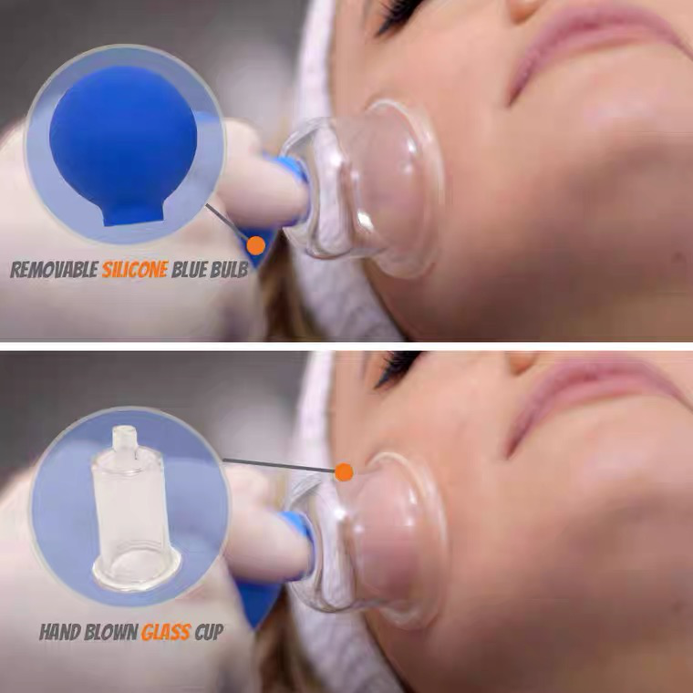 Skin lifting facial cups